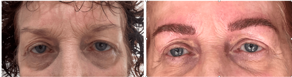 Lovely natural results