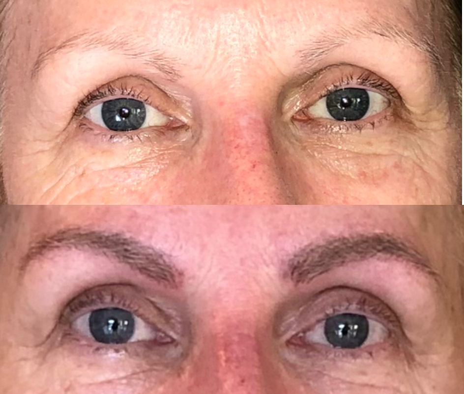 Carefully getting the right&nbsp;shape